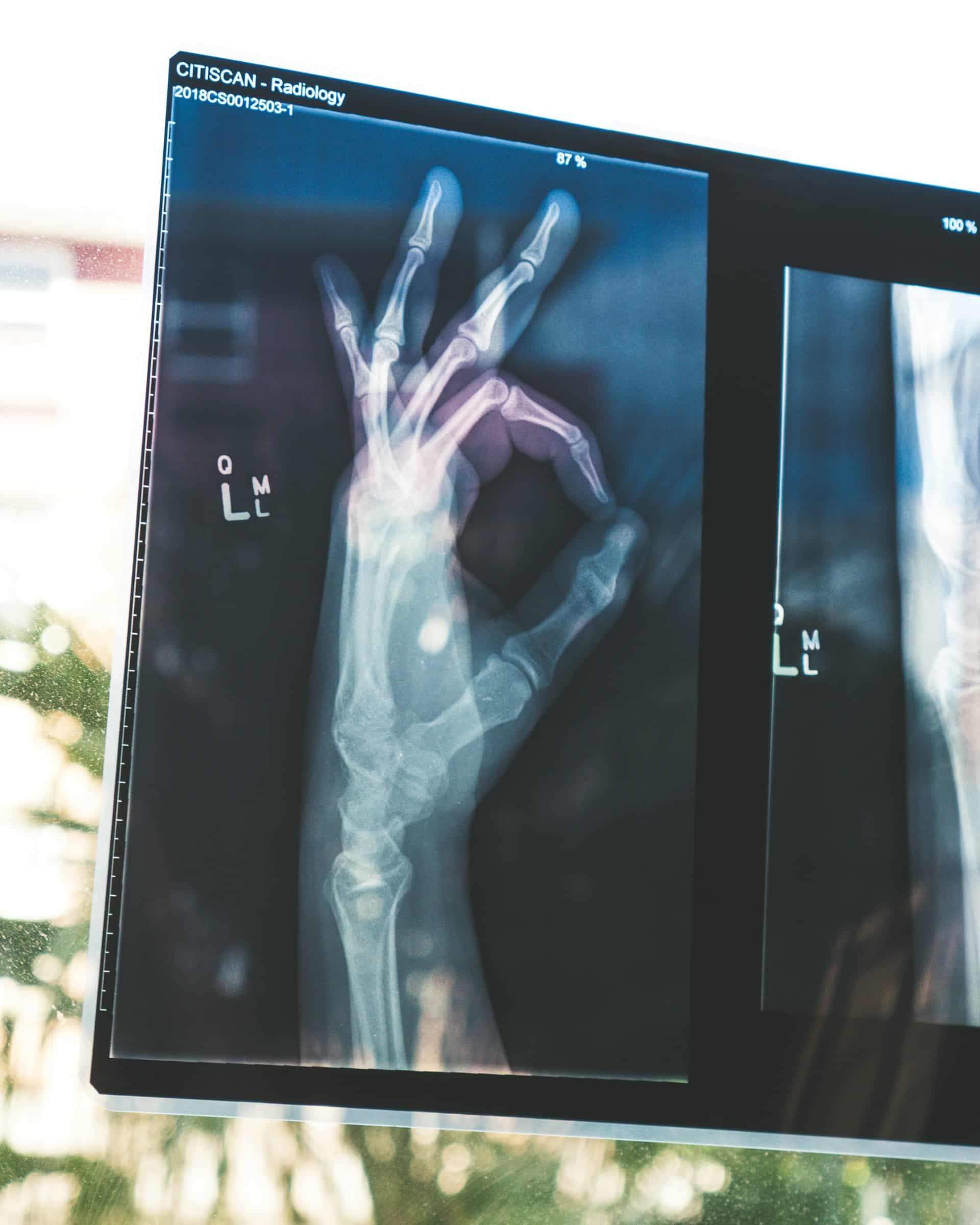 a hand with an 'okay' gesture, symbolizing reassurance before surgery. Overcome fear of surgery with Hypnosis / Hypnotherapy