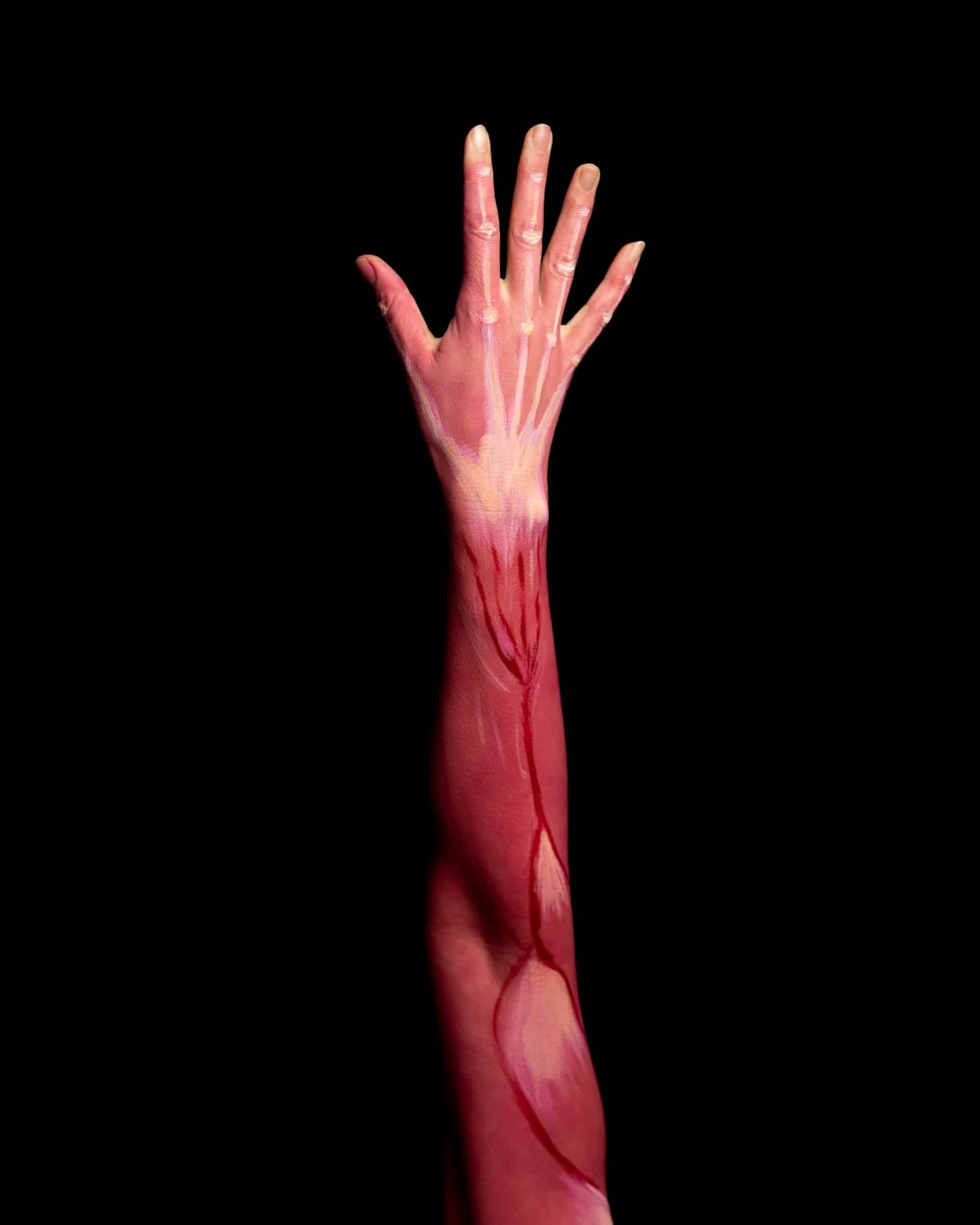 Small Fiber Neuropathy UK - Hypnotherapy for Numbness in Legs and Feet